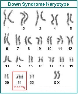 Down Syndrome Karyotype Colorful