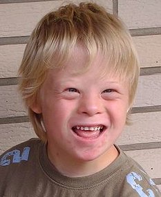 photo of an 8 year old boy with Down Syndrome
