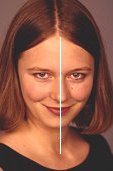 photo of a woman's head illustrating bilateral symmetry