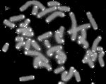 Black and white photo of human chromosomes with telomeres shown in white