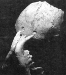photo of an early hominid skull from Swartkrans showing a leopard's canines fitting puncture holes in the skull cap