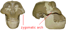 photo of a robust early hominid skull with the zygomatic arches highlighted