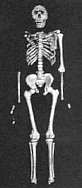 photo of the Lake Turkana Boy skeleton