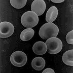 microscopic photo of normal human red blood cells