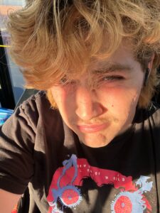 A man with blonde, curly hair is making a face and in partial shadow. He wears a black shirt.